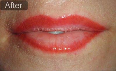 Permanent Makeup of Lip Liner - After